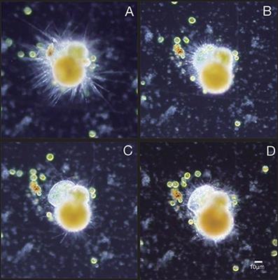 Reading the Fine Print: Ultra-Microstructures of Foraminiferal Calcification Revealed Using Focused Ion Beam Microscopy